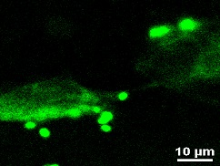 GFP